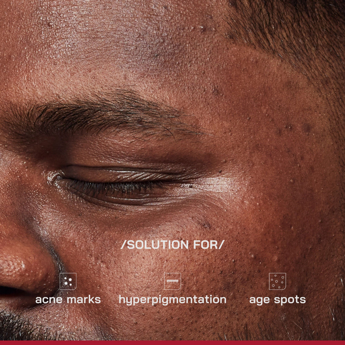 Image 3 of Proven Honest Derma (PHD) 2% Alpha Arbutin Serum