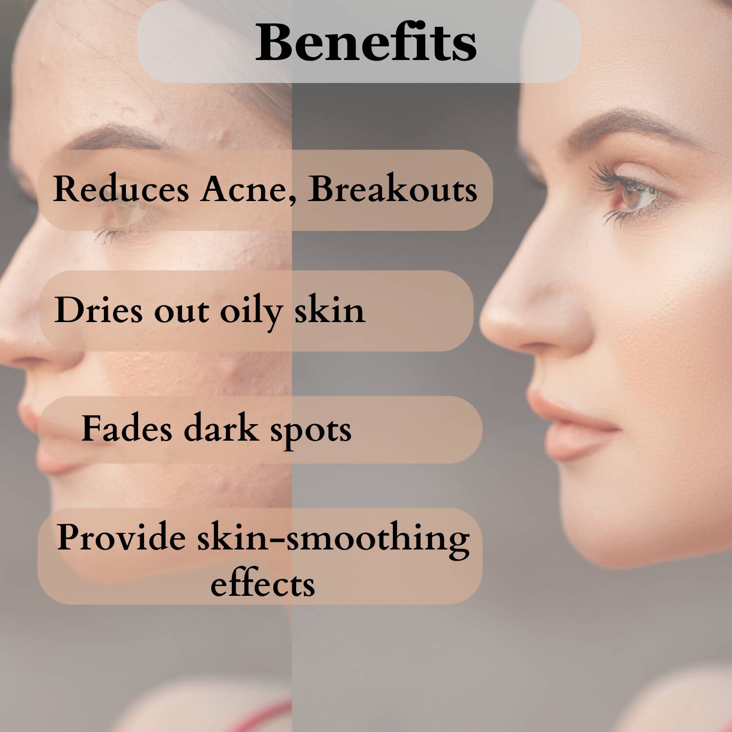 https://cdn.shopify.com/s/files/1/1857/6931/products/bBi9ZMFReG.jpg?v=1709970888