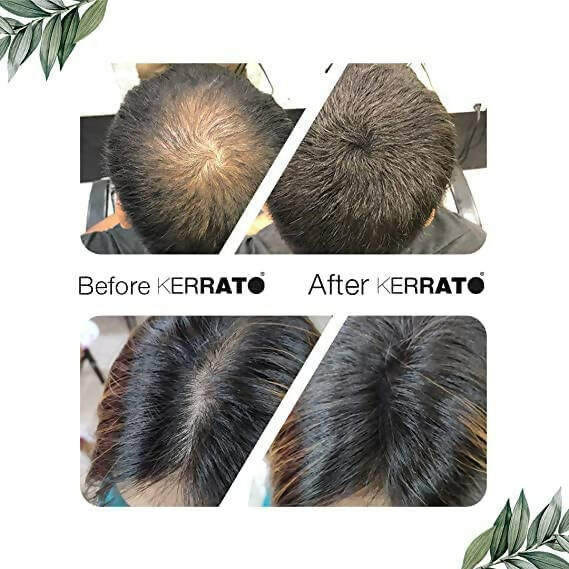 https://cdn.shopify.com/s/files/1/1857/6931/products/bRB5CkvSJB.jpg?v=1706592052