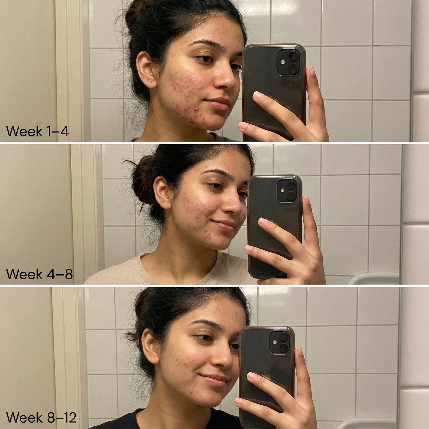 https://cdn.shopify.com/s/files/1/1857/6931/files/before-after.jpg?v=1775477455