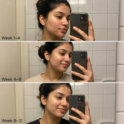 https://cdn.shopify.com/s/files/1/1857/6931/files/before-after.jpg?v=1775477455