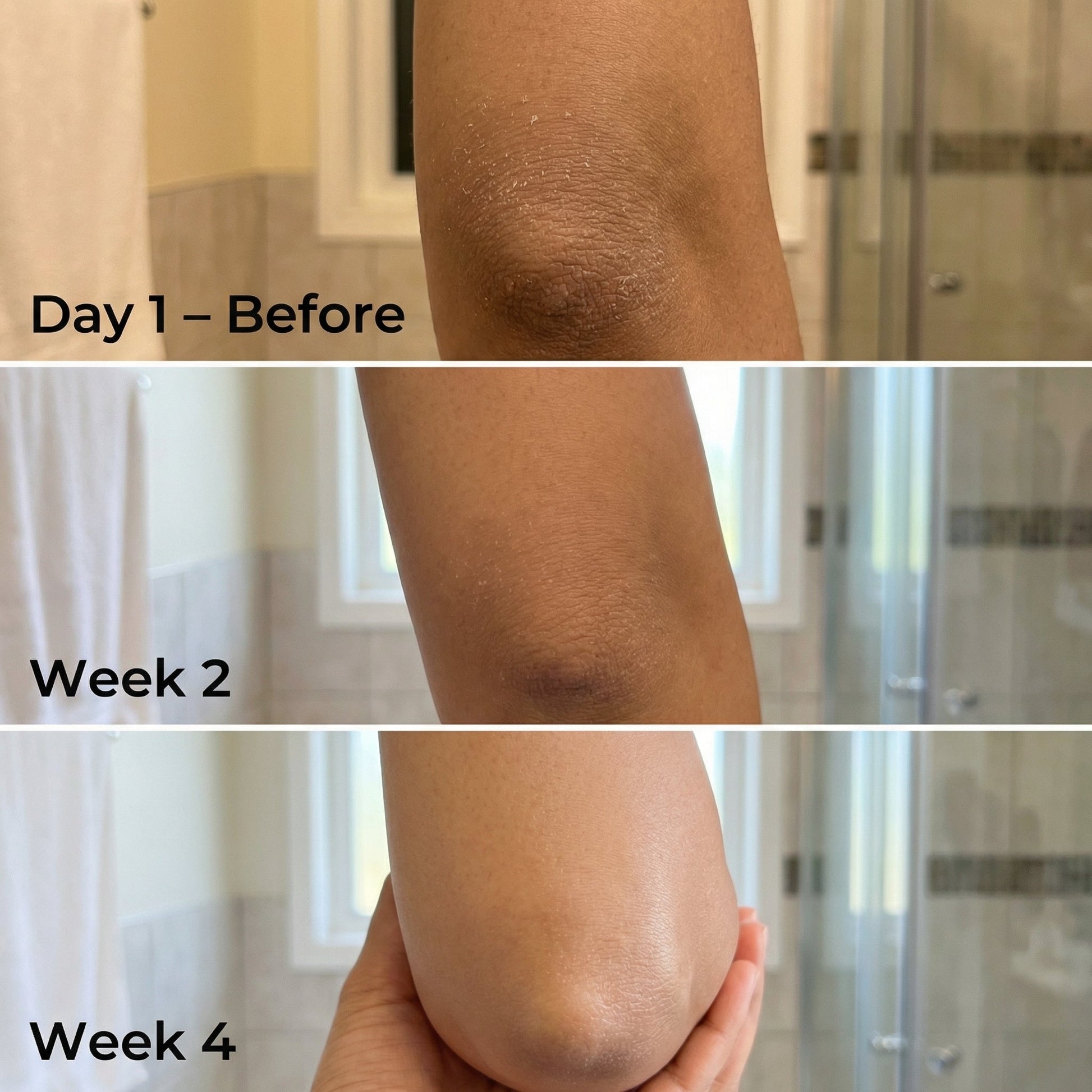 https://cdn.shopify.com/s/files/1/1857/6931/files/before_after.jpg?v=1775477474