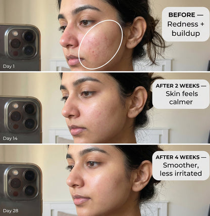 https://cdn.shopify.com/s/files/1/1857/6931/files/before_after_050db84f-997d-4d85-a4cb-ee0a649ff94d.jpg?v=1775477452