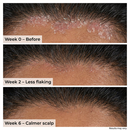 https://cdn.shopify.com/s/files/1/1857/6931/files/before_after_18164d9f-8f1f-46e1-b312-99562e7f643b.jpg?v=1775477493