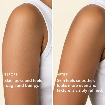 https://cdn.shopify.com/s/files/1/1857/6931/files/boofootel-bumpy-skin-before-after-results.webp?v=1778138344
