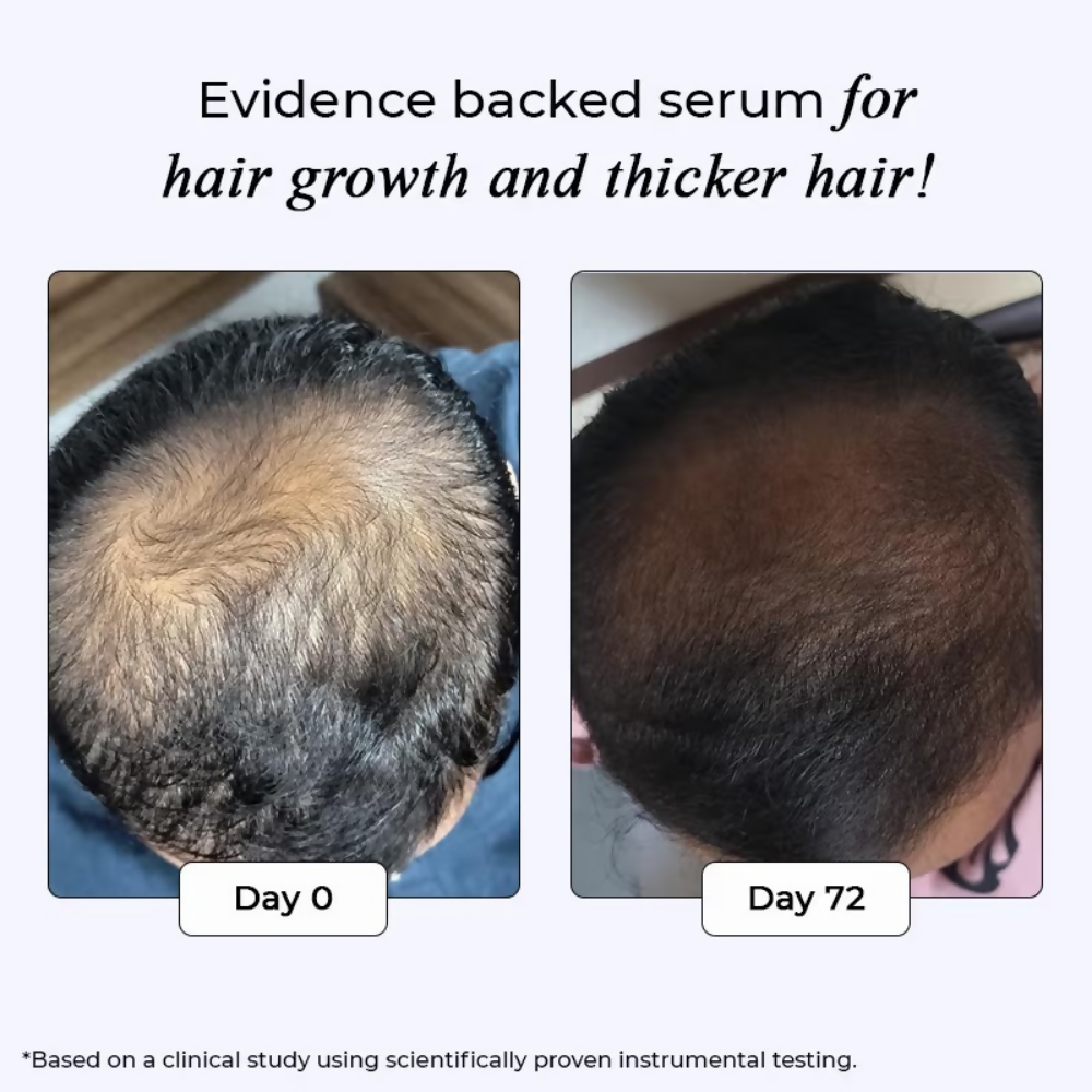 Image 4 of Dr. Su Revive Hair Growth Serum Hairfall Control