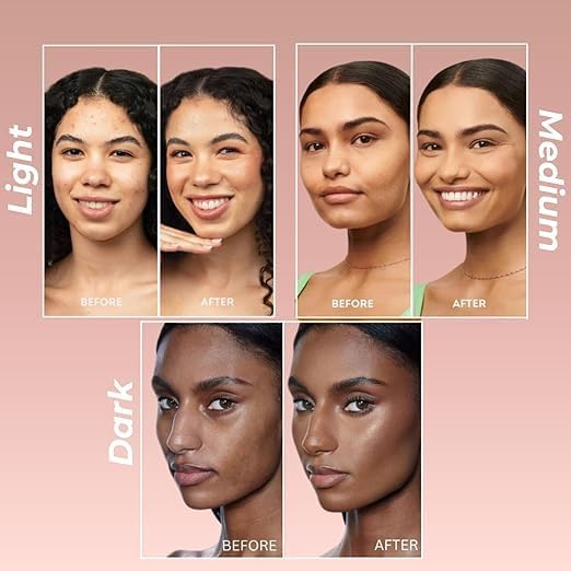 Image 5 of Suroskie My Glow Tinted Moisturizer, 60ml, Medium Shade, SPF 30, With Niacinamide and Natural Extracts