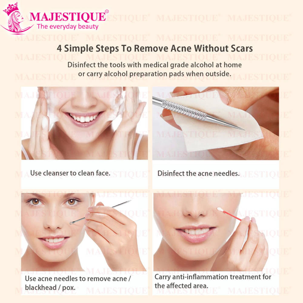 Image 4 of Majestique Blackhead Remover