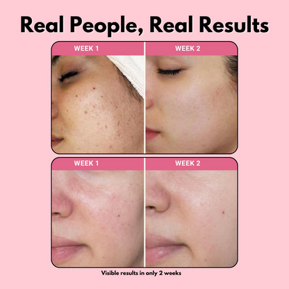 https://cdn.shopify.com/s/files/1/1857/6931/files/dNfVYhL5xV.png?v=1731318070