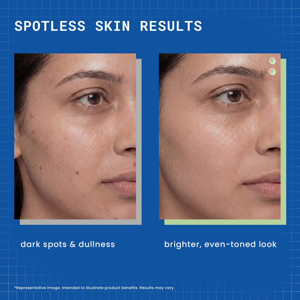 Image 8 of Dermdoc 2% Kojic Acid Face Serum