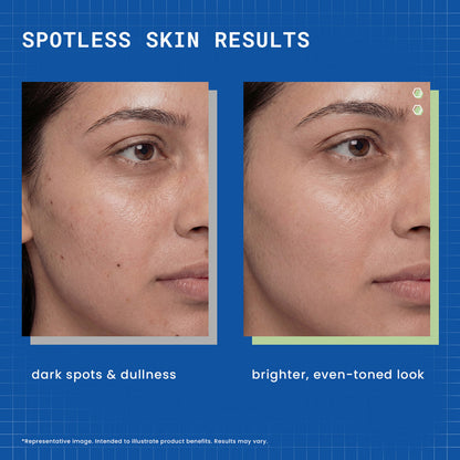 Image 8 of Dermdoc 2% Kojic Acid Face Serum