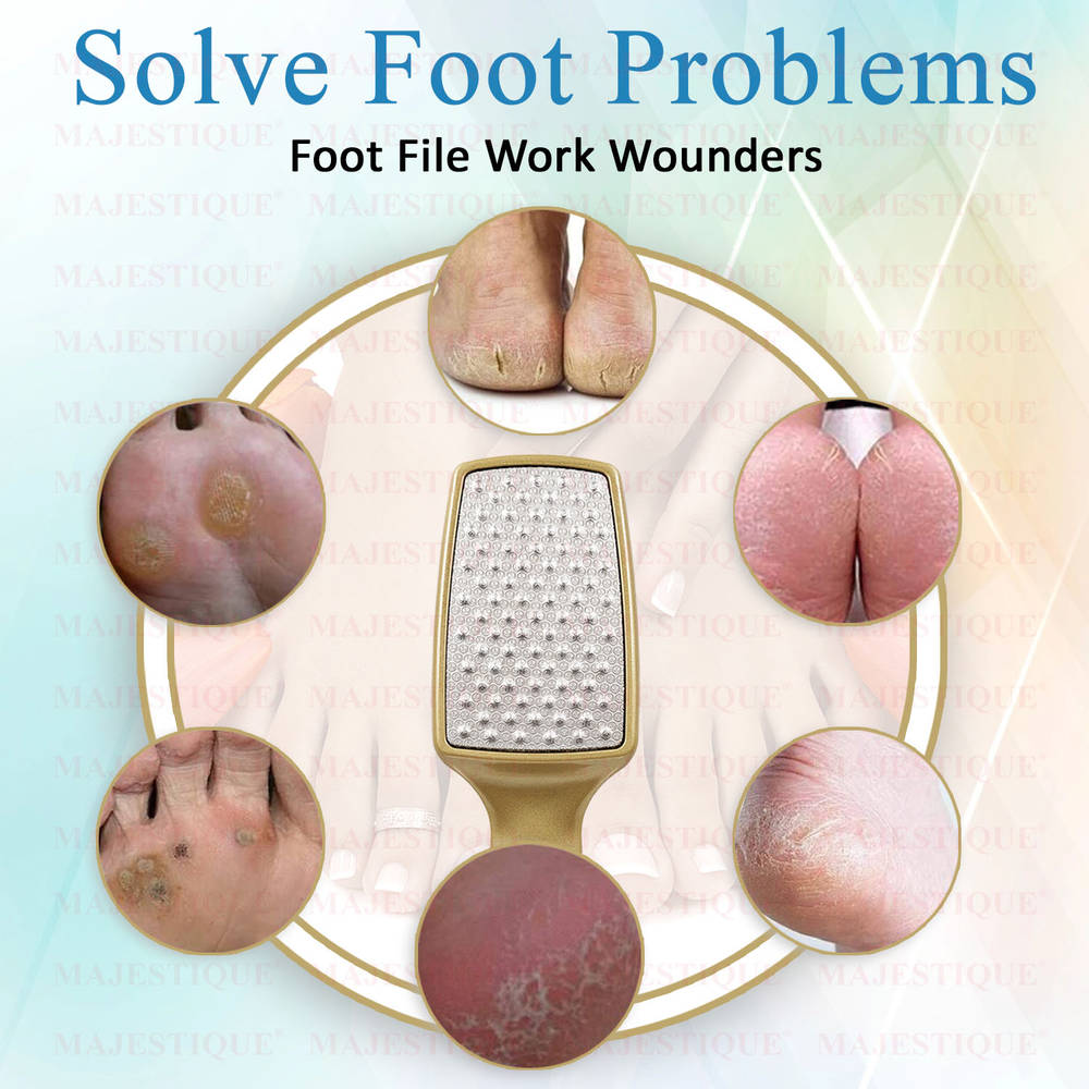 Image 6 of Majestique Professional Foot File - Laser-Cut Steel, Safe Dead Skin Remover - Color May Vary