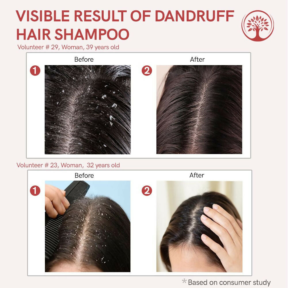 https://cdn.shopify.com/s/files/1/1857/6931/files/eNZNIcgTAg.jpg?v=1717585920