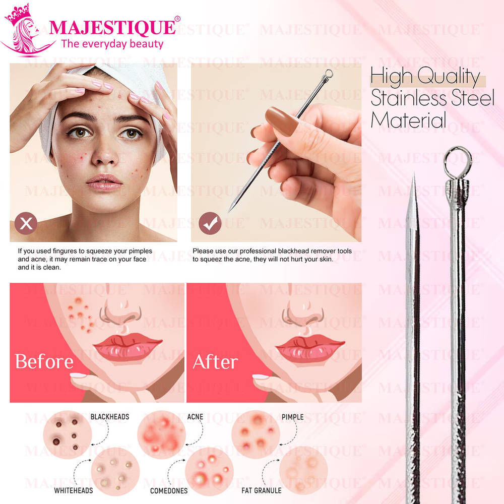 Image 2 of Majestique Blackhead Remover