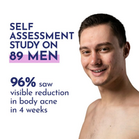 https://cdn.shopify.com/s/files/1/1857/6931/files/ekGes3vejG.png?v=1731065398