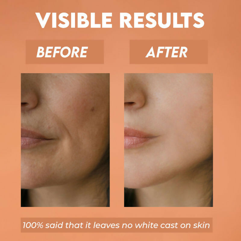 https://cdn.shopify.com/s/files/1/1857/6931/files/epzM4w7Kwu.jpg?v=1742818465