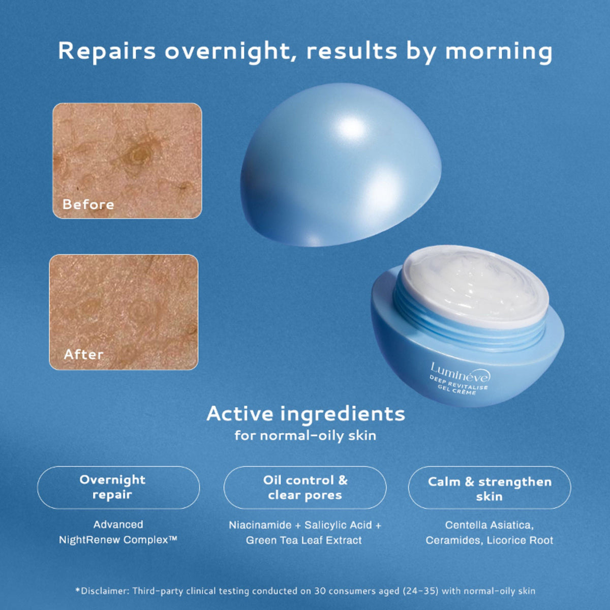 Image 4 of Lumineve Gel Moisturizer for Oily Skin with Salicylic Acid for Oil Control