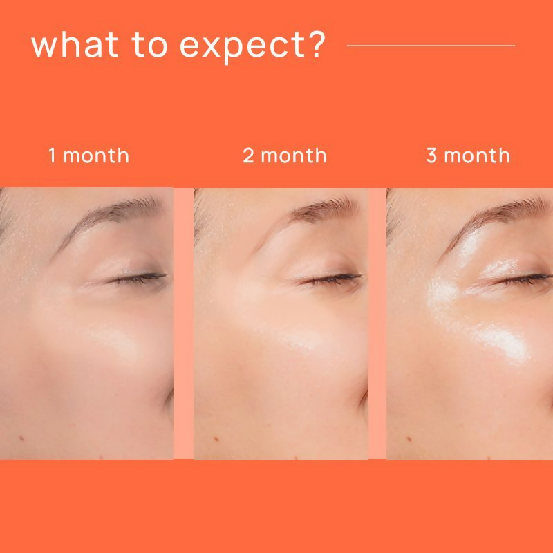 https://cdn.shopify.com/s/files/1/1857/6931/files/gBFOQ6YGsO.png?v=1730194712