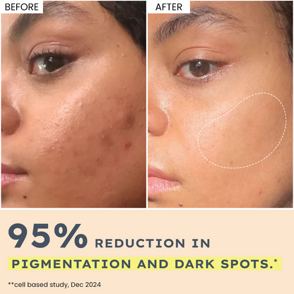 https://cdn.shopify.com/s/files/1/1857/6931/files/hLYbzJYB6i.png?v=1740055539