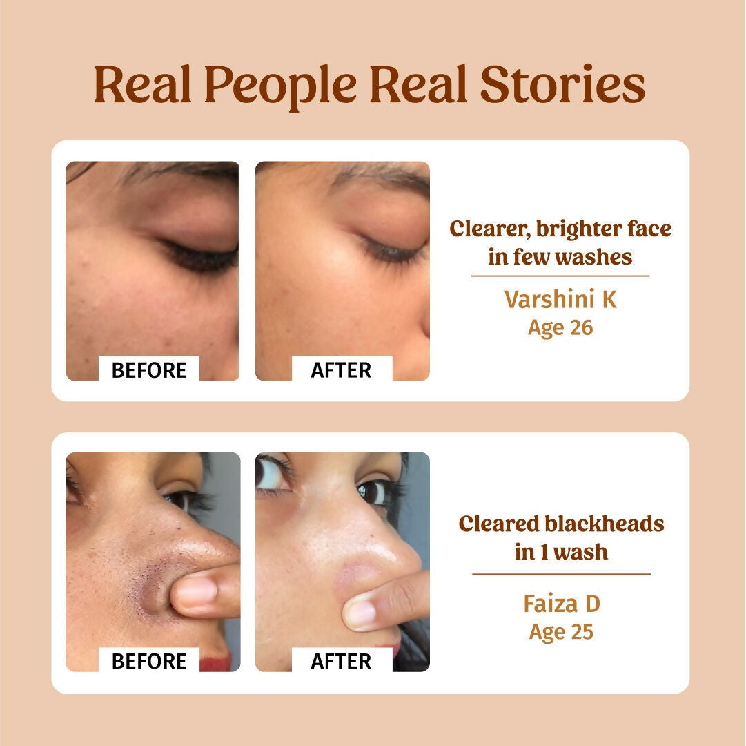 https://cdn.shopify.com/s/files/1/1857/6931/files/kbXoX4bGvS.jpg?v=1755600376