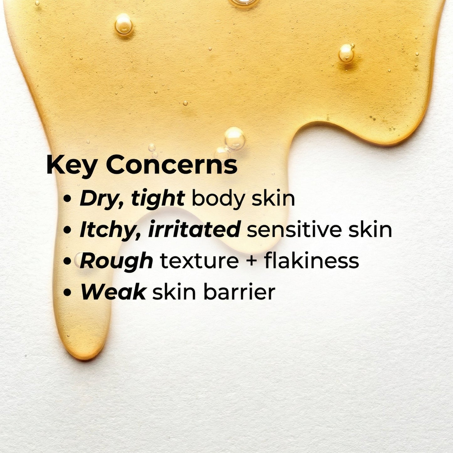 https://cdn.shopify.com/s/files/1/1857/6931/files/key_concerns.jpg?v=1775477474