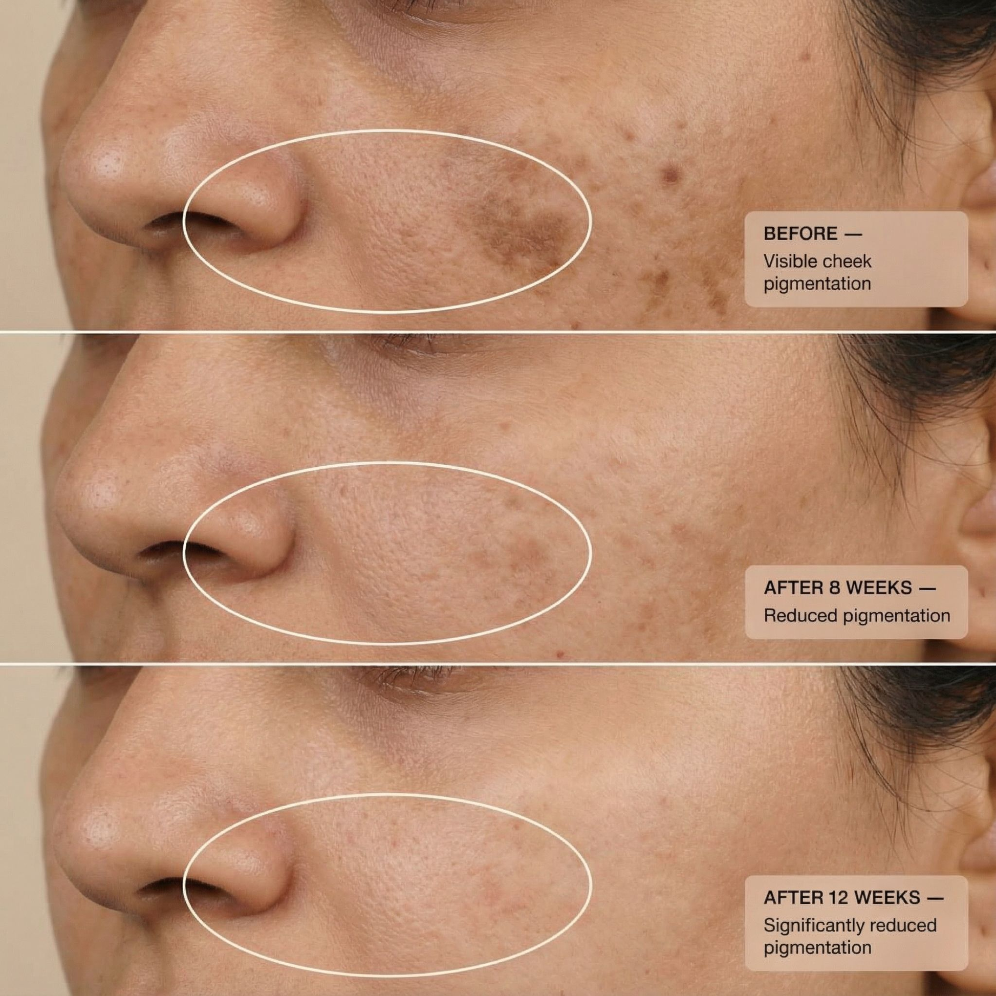 https://cdn.shopify.com/s/files/1/1857/6931/files/kumkumadi_before_after.png?v=1775655122