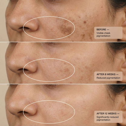 https://cdn.shopify.com/s/files/1/1857/6931/files/kumkumadi_before_after.png?v=1775655122