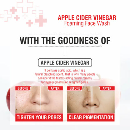 https://cdn.shopify.com/s/files/1/1857/6931/files/nuerma-science-apple-cider-vinegar-foaming-face-wash-with-vitamin-b5-for-oil-free-skin-150ml-product-images-orvhppomngw-p600860846-5-202304241247.webp?v=1765546382