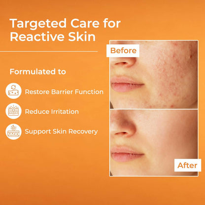 Image 3 of Brinton Uv Doux Restore Moisturizer
