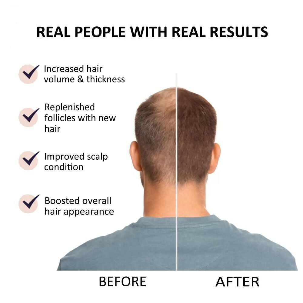 https://cdn.shopify.com/s/files/1/1857/6931/files/tohXtDA33I.jpg?v=1754890372
