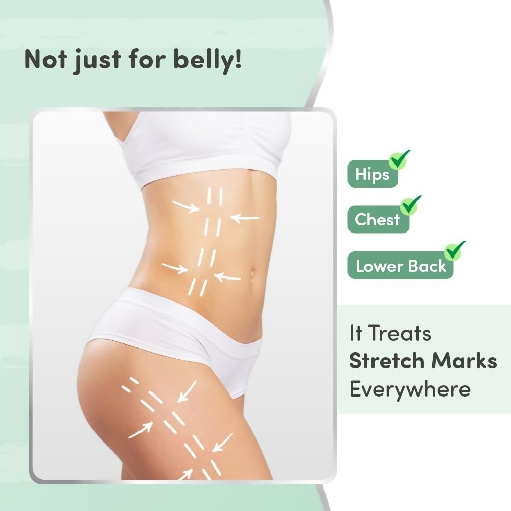 https://cdn.shopify.com/s/files/1/1857/6931/files/u1GLTof6i2.png?v=1737951727