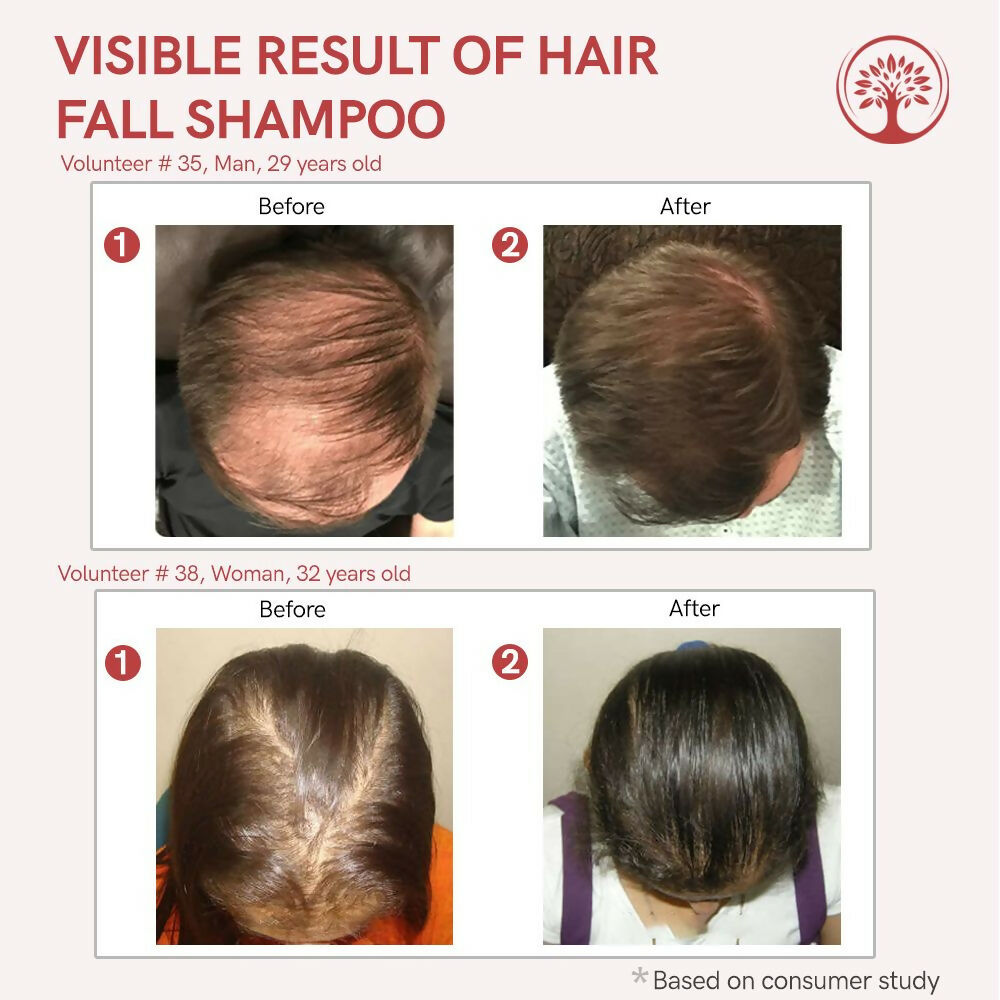 https://cdn.shopify.com/s/files/1/1857/6931/files/vbTylTQLgJ.jpg?v=1717585867