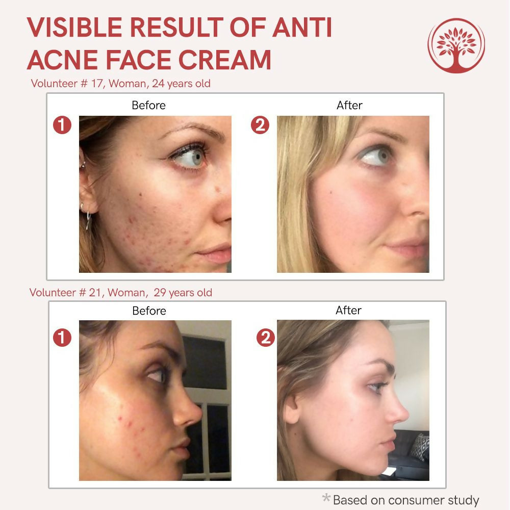 https://cdn.shopify.com/s/files/1/1857/6931/files/yk99BNE6Pi.jpg?v=1718000572