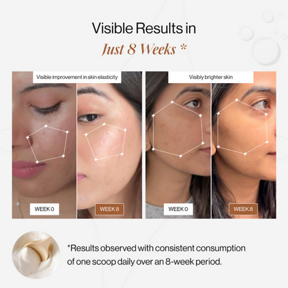 https://cdn.shopify.com/s/files/1/1857/6931/files/yzLpmYdKk1.png?v=1742468578